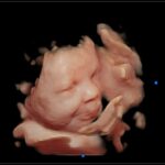 Capture your baby with 3D 4D 5D Ultrasounds in Baltimore, Harford and Cecil County Maryland.
