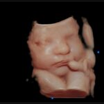 Capture your baby in stunning detail with 3D 4D 5D Ultrasound imaging. Baltimore, Harford and Cecil County Maryland.