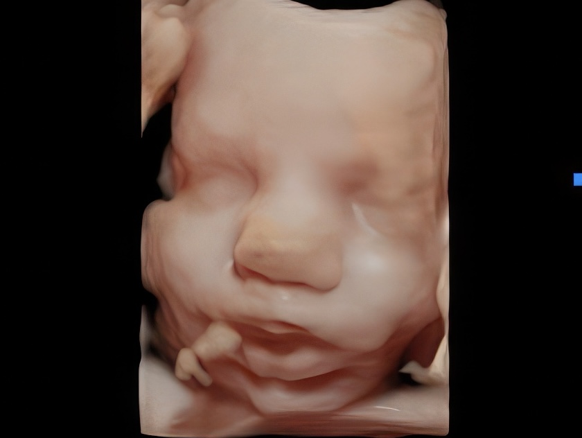 Enhanced 3D ultrasound image of a baby’s face during in-home session in Middle River, Maryland