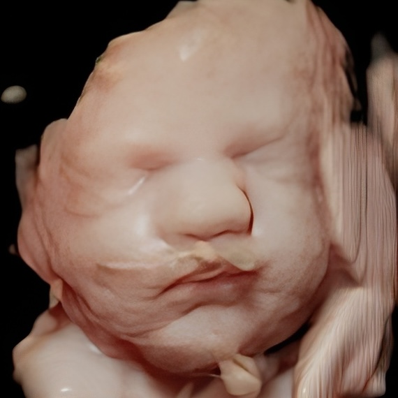 Enhanced 3D ultrasound image of a baby’s face during in-home session in Havre de Grace, Maryland