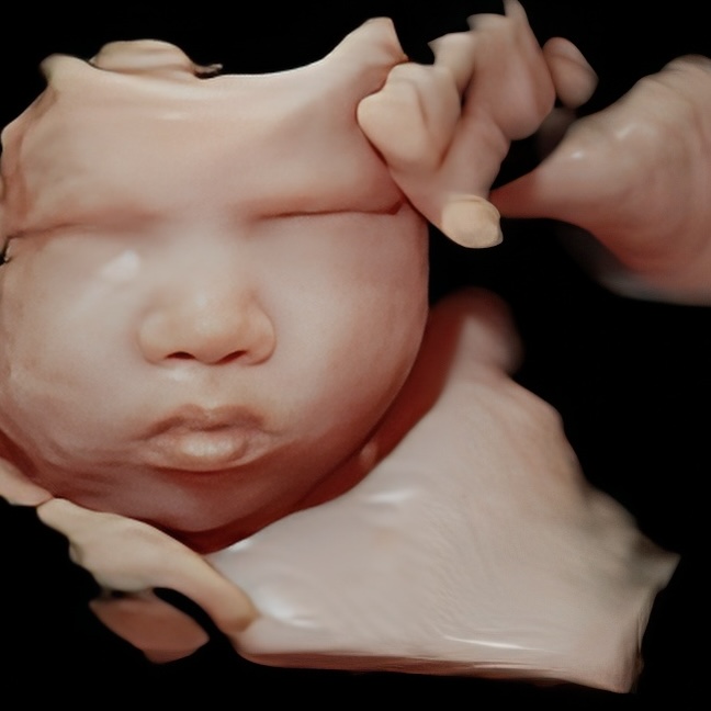 Enhanced 3D ultrasound image of a baby’s face during in-home session in Abingdon, Maryland