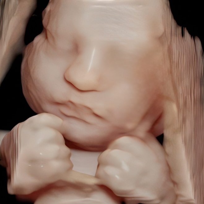 Enhanced 3D ultrasound image of a baby’s face during in-home session in Monkton, Maryland