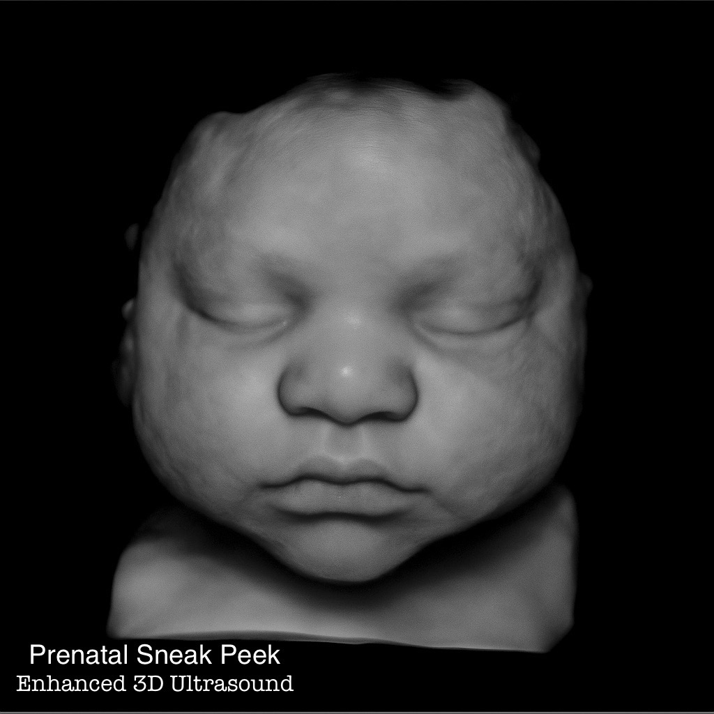 Enhanced 3D ultrasound image of a baby’s face during in-home session in Aberdeen, Maryland