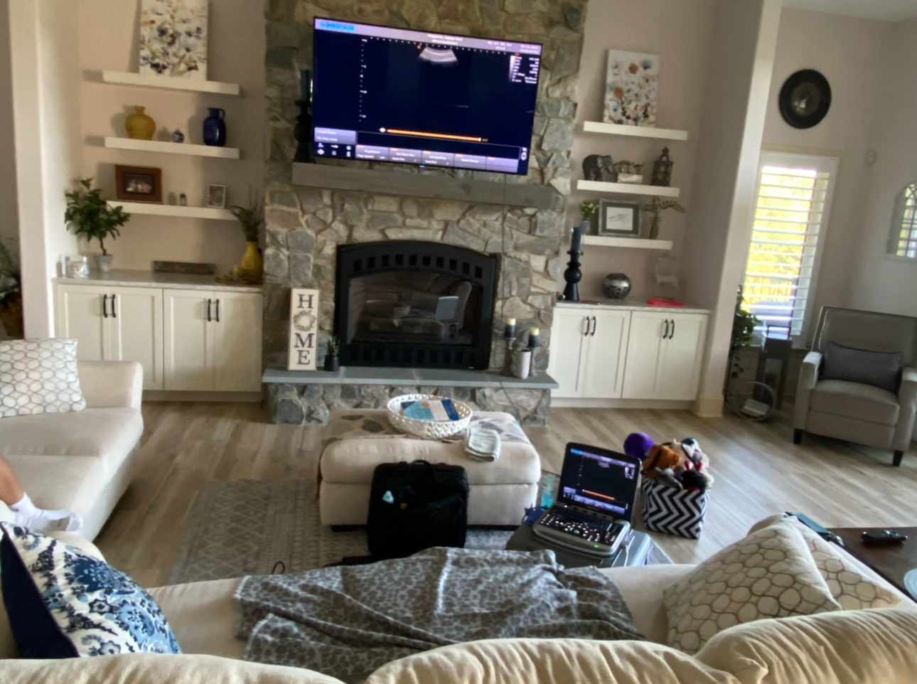In-home ultrasound setup in a cozy living room during mobile 3D ultrasound session in Bel Air Maryland