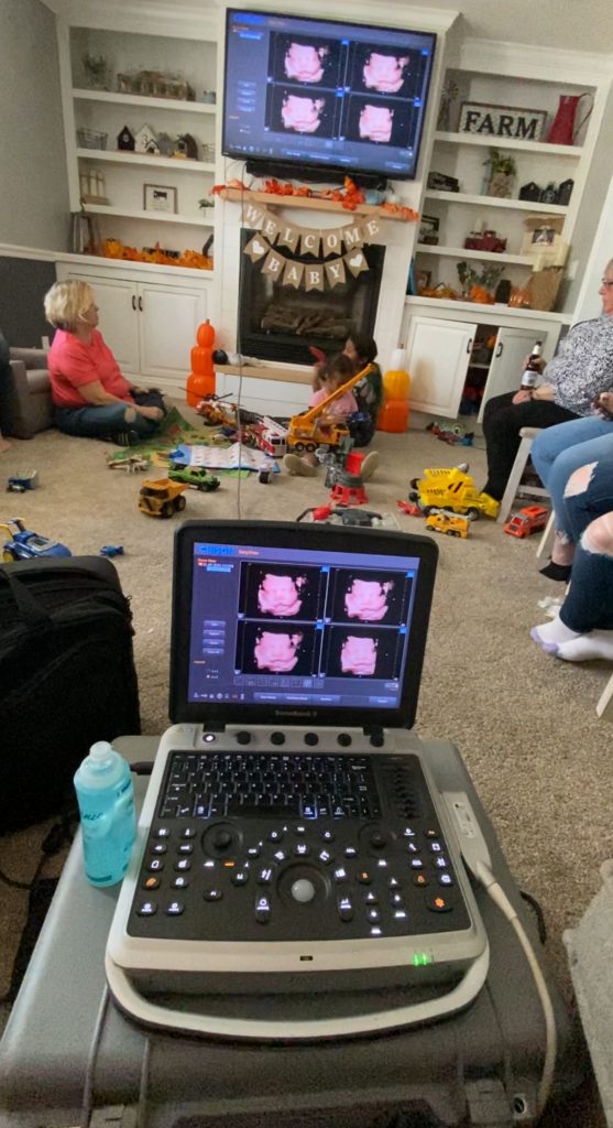 Mobile 3D ultrasound setup in a cozy living room