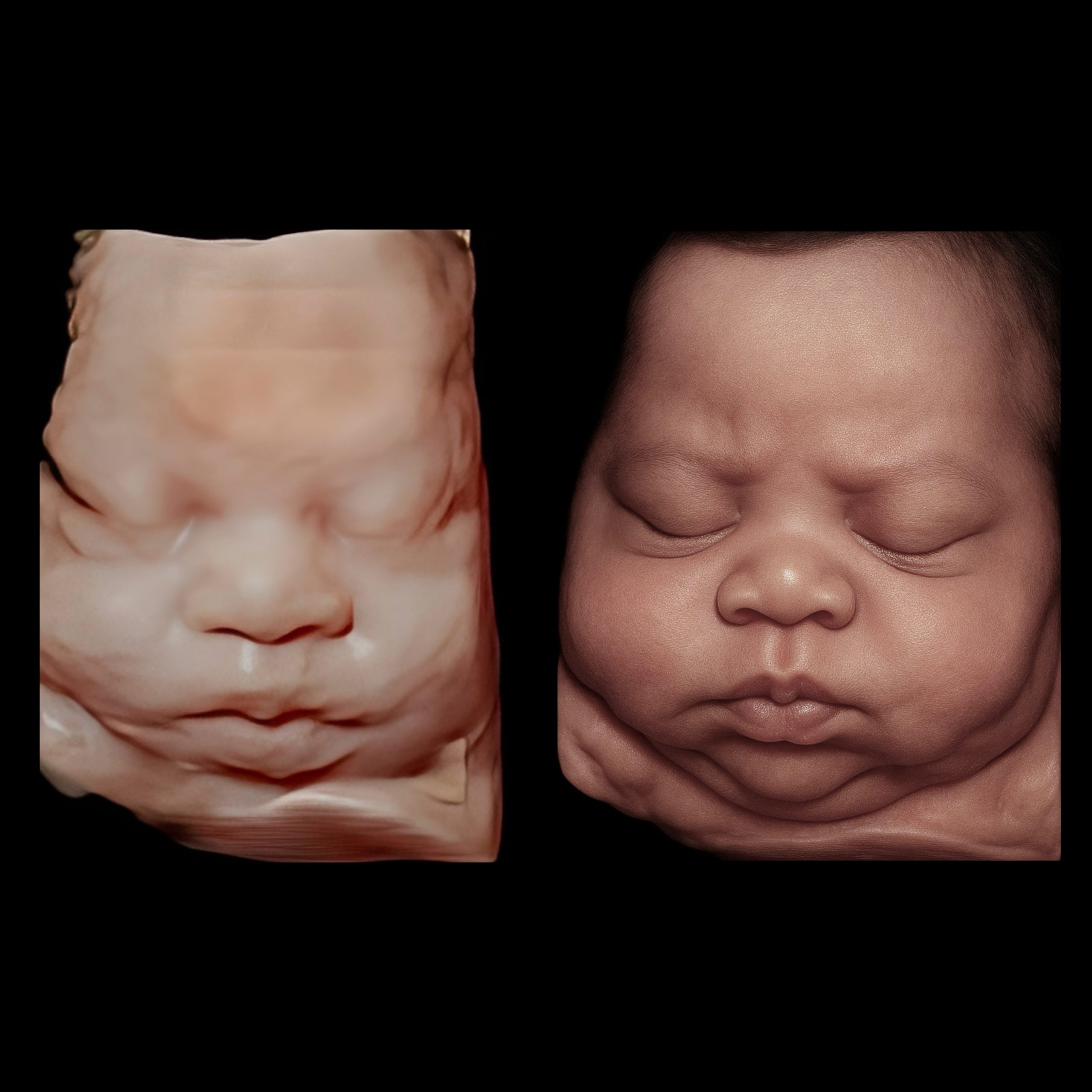 Enhanced 8K 3D ultrasound image of a baby’s face during in-home session in Bel Air, Maryland