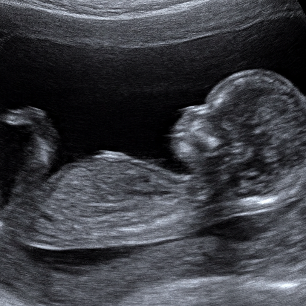 2D ultrasound profile image of baby during early pregnancy scan by registered sonographer in Maryland.