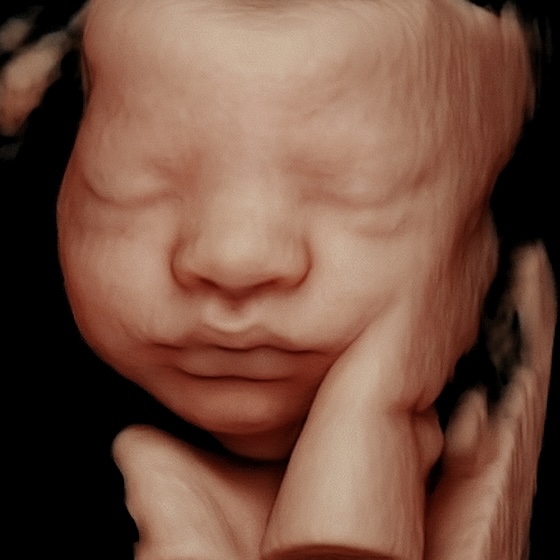 Lifelike 3D ultrasound image of baby’s face from in-home session in Bel Air, Mary